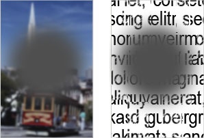 macular degeneration